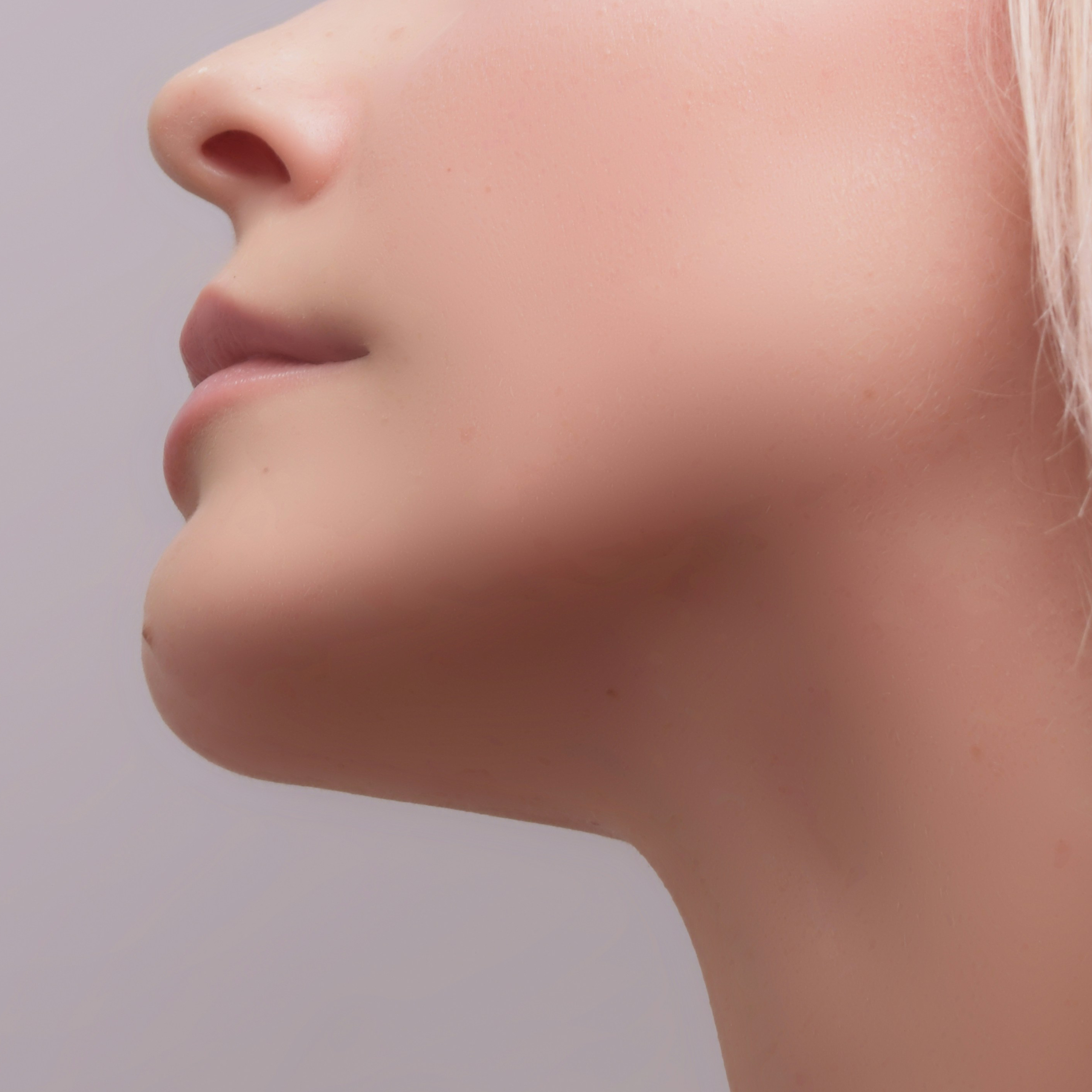 Nasolabial folds