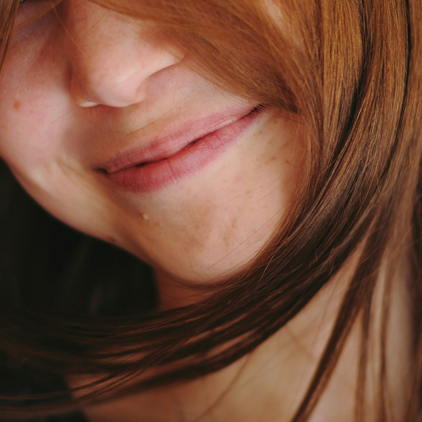 Mentalis - Dimpled Chin