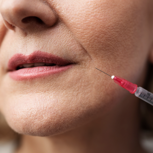 Dermal Filler Treatments